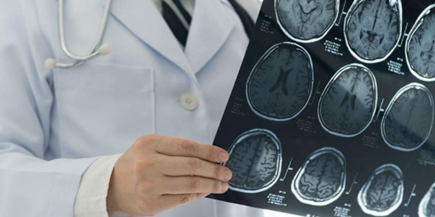 MS tedavisindeki gelişmeler yüz güldürüyor